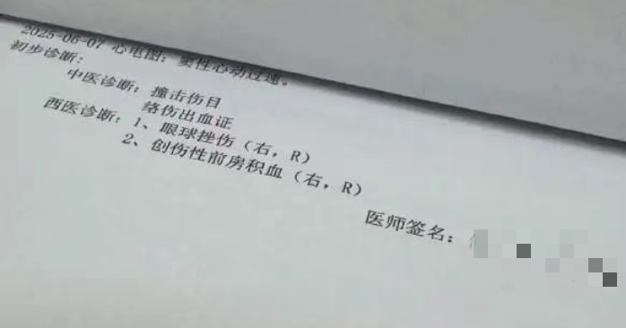 眼外傷